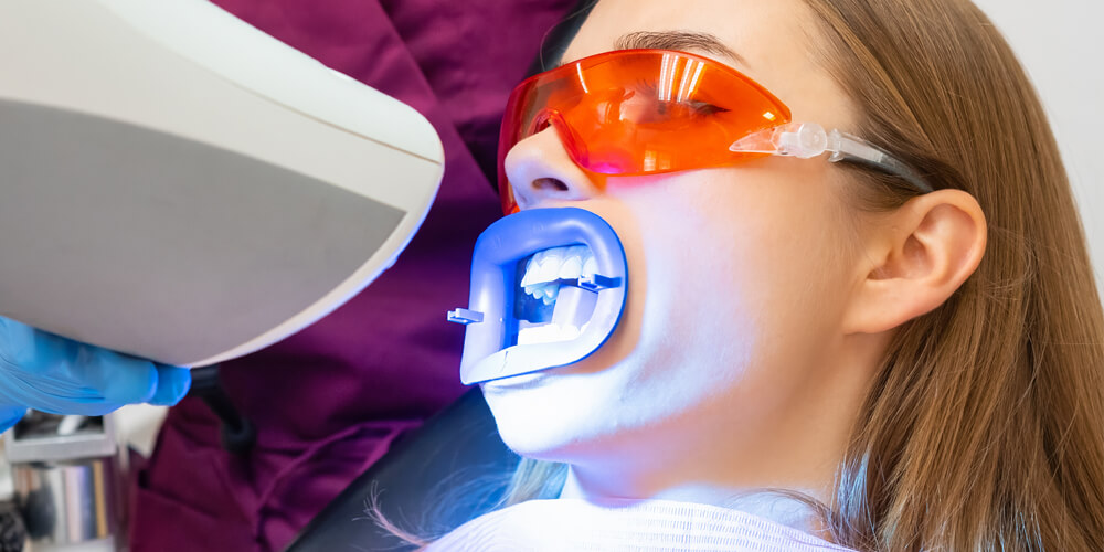 Teeth Whitening Lloydminster